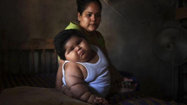 Bayi laki-laki bernama Luis Manuel Gonzales ini memiliki berat badan yang setara dengan anak berusia sembilan tahun. 