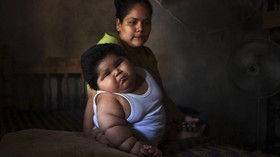 'Bayi Raksasa' 10 Bulan Punya Berat Setara Anak 9 Tahun