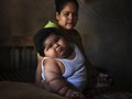 'Bayi Raksasa' 10 Bulan Punya Berat Setara Anak 9 Tahun