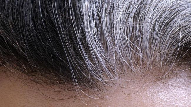 Uban atau dalam bahasa 'kerennya' silver hair seringkali jadi momok menakutkan untuk sebagian besar orang. Padahal uban di usia dewasa adalah hal wajar. 
