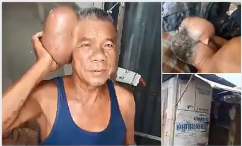 Kondisi Aneh Buat Kakek Asal Thailand Dijuluki Pria Berkepala Dua Kondisi Aneh Buat Kakek Asal Thailand Dijuluki Pria Berkepala Dua