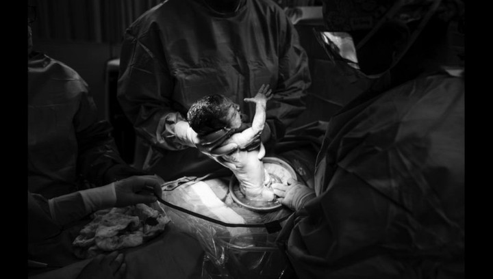 Begini momen melahirkan Maria, seorang bunda yang didiagnosis kanker payudara saat hamil anak ke-empatnya. 