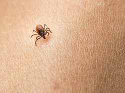 Perubahan Iklim Berpotensi Bikin Penyakit Lyme Makin Merebak