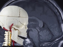 Riwayat Gegar Otak Picu Turunnya Kemampuan Kognitif, Begini Studinya