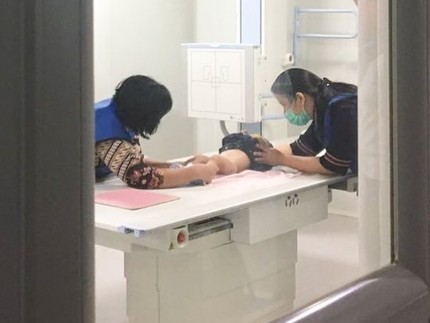 Dandy Walker Syndrome, Kondisi yang Juga Dialami Adam Fabumi