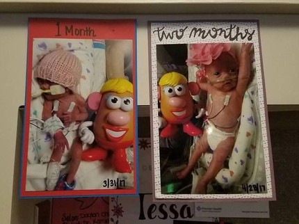 Potret Mr dan Mrs Potato Head Bantu Pantau Perkembangan Bayi Prematur