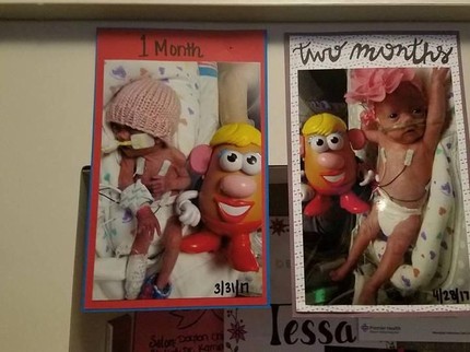 Saat Tokoh Kartun Mr Potato Head Bantu Pantau Perkembangan Bayi Prematur