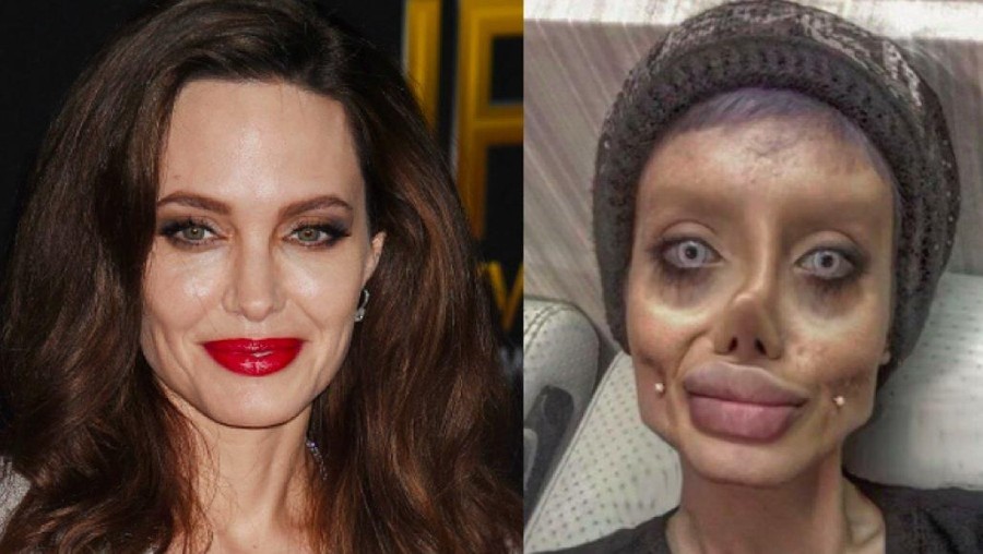 Sahar Tabar Sahar Tabar operasi mirip Angelina Jolie