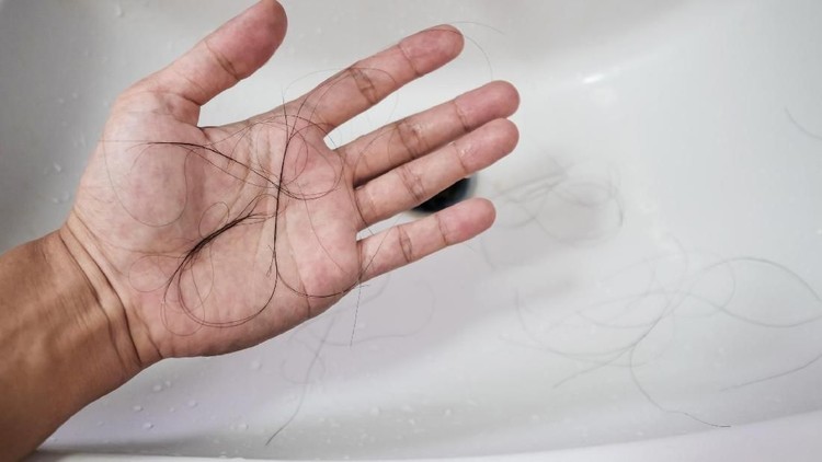 Setelah si kecil lahir, masih ada keluhan yang bisa dialami bunda: rambut rontok parah. Mengalami juga nggak, Bun?