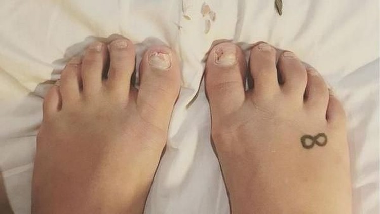 Saat hamil, ibu ini punya keluhan dengan kuku kakinya. Kukunya jadi rapuh, gampang rusak.