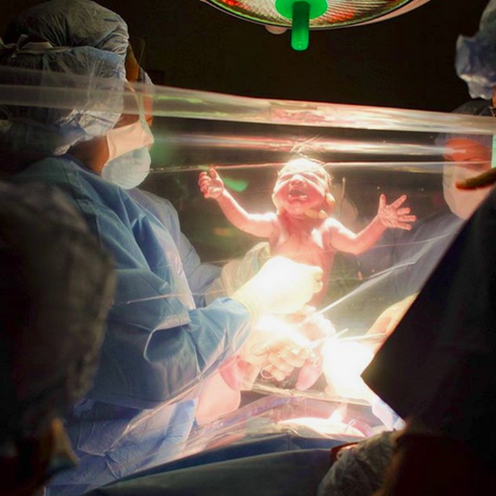 <p>Beginilah momen saat tangis si kecil pecah sesaat setelah dia lahir ke dunia. (Foto: Instagram/ @cherryblossom_doula)</p>