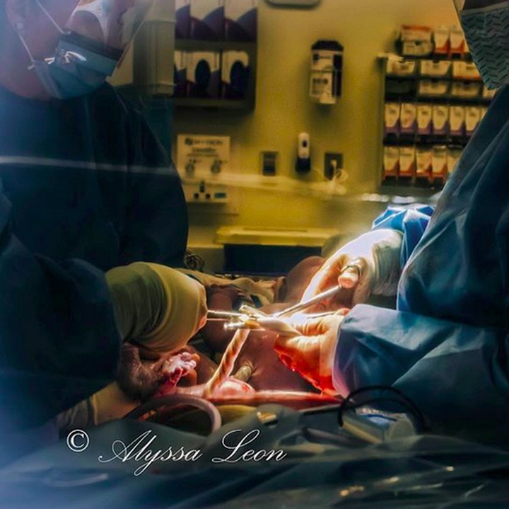 <p>Ini saat proses pemotongan tali pusar, Bun. (Foto: Instagram/ @cherryblossom_doula)  </p>