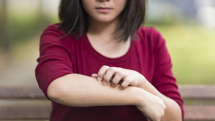 Kulit anak merah-merah, kita langsung menduga si kecil alergi. Hmm, seperti apa faktanya?