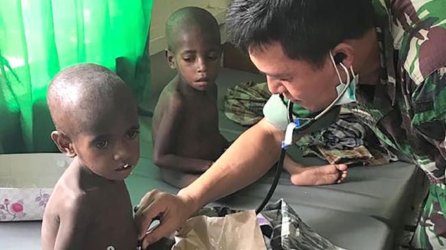 Wabah campak dan kasus gizi buruk di Asmat Papua sebabkan 68 anak meninggal dunia, dan yang dirawat bertambah jumlahnya dari 18, kini 33 orang per Jumat (19/1).
