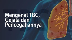Mengenal TBC, Gejala dan Pencegahannya