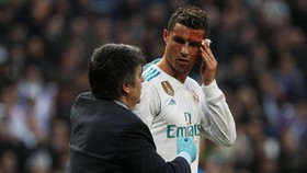 Viral, Ronaldo Berkaca Saat Pelipis Bocor