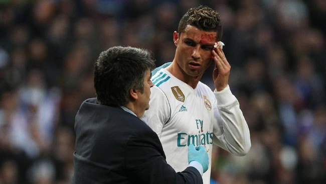Pelatih Real Madrid Zinedine Zidane membela Cristiano Ronaldo yang dicemooh karena berkaca dengan telepon genggam tim medis ketika pelipisnya berdarah.