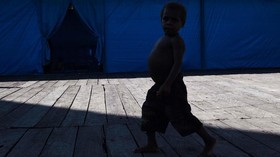 Sebanyak 194 Anak Jakarta Utara Alami Gizi Buruk Tahun Lalu
