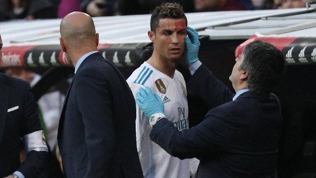 Zinedine Zidane mengatakan Cristiano Ronaldo hanya butuh dua atau tiga jahitan atas luka di kepalanya. Madrid menang 7-1 atas Deportivo La Coruna.