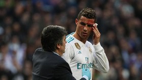Ronaldo Latihan Bersama Real Madrid dengan Mata Bengkak