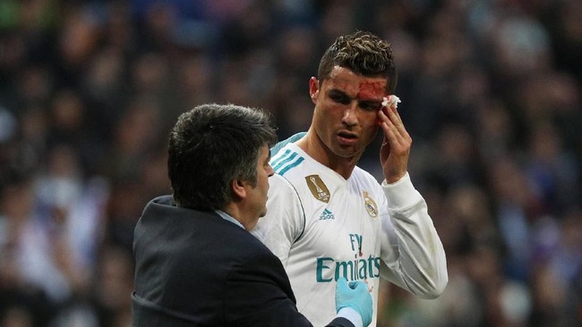 Cristiano Ronaldo sudah tampak berlatih bersama Real Madrid pada Selasa (23/2), namun kondisi matanya bengkak akibat tertendang bek Deportivo La Coruna.
