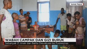 Wabah Campak dan Gizi Buruk