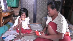 VIDEO: Puluhan Anak di Tangerang Alami Gizi Buruk