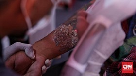 Hapus Tato Berjamaah di Masjid Cut Mutia