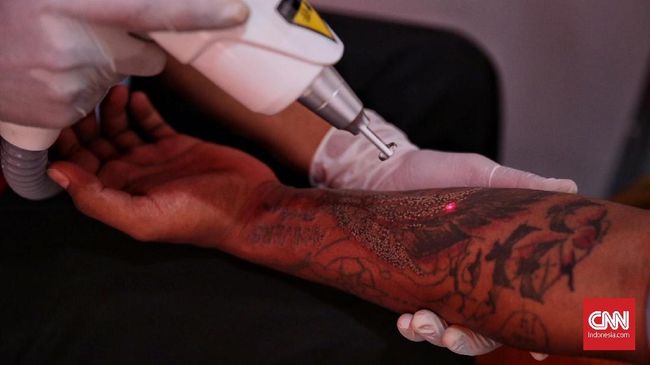 Bagi sebagian orang, menghapus tato tak hanya sekadar tindakan membersihkan kulit dari seni rajah semata. Lebih jauh, ini seolah menjadi pintu menuju hijrah.