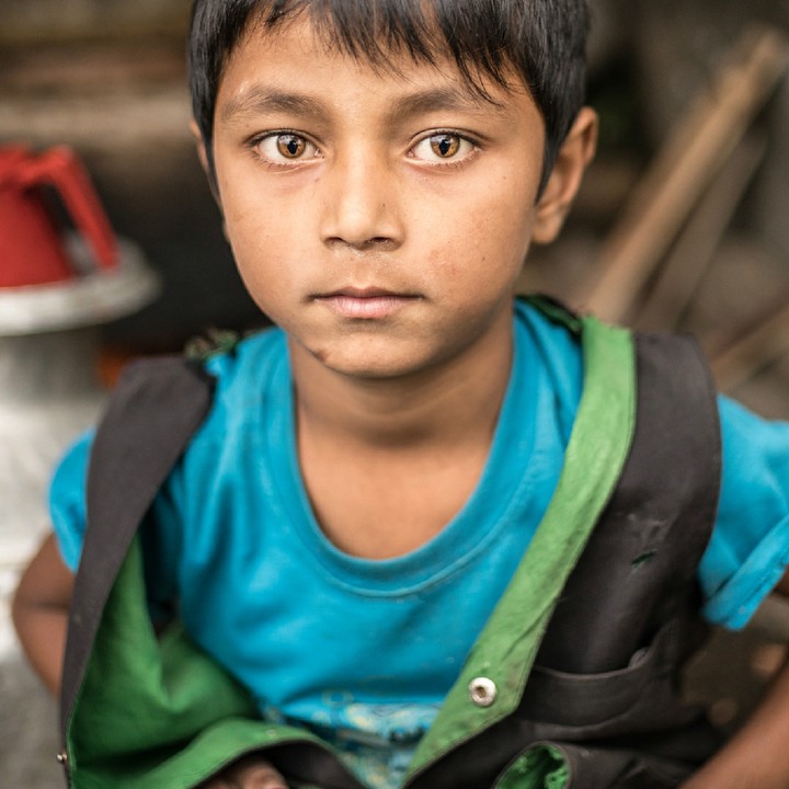 <p>Padahal anak ini mengidap 'cat eye sindrome'. Namun, dia tetap tersenyum. (Foto: Instagram/renan_ozturk)</p>
