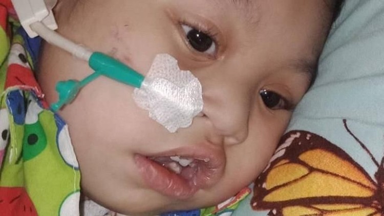 Bermula dari Tokso, Anak 2,5 Tahun Ini Masih Seperti Bayi Di usianya yang 2,5 tahun, bocah ini belum bisa berjalan. Semua bermula dari tokso...