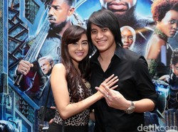 Cerita Kevin Aprilio Terbang ke Turki Demi Cangkok Rambut