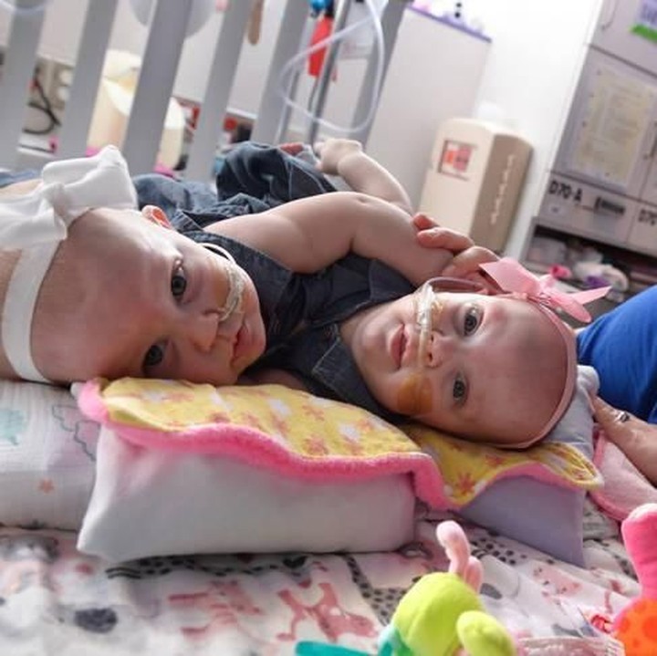 <p>Ahli anestesi, kardiolog, dan perawat dari delapan spesialisasi berbeda berkolaborasi dalam melakukan operasi tersebut. (Foto: Allen S. Kramer/Texas Children’s Hospital)</p>