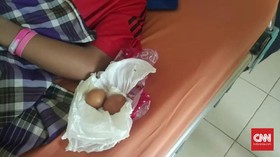 Polisi Sebut Remaja Gowa Masukkan Telur ke Dalam Tubuhnya