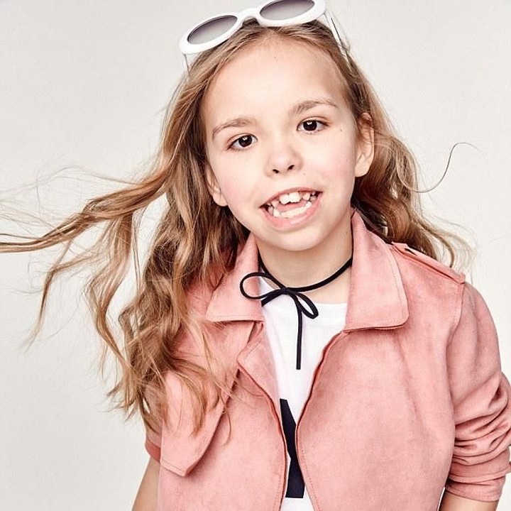 <p>Model cilik ini bernama Lois, lahir dengan sindrom 18q deletion yang langka. Lois terlahir tuli dan mudah capek. Terlepas dari itu, posenya sangat natural. Keren! (Foto: River Island)</p>