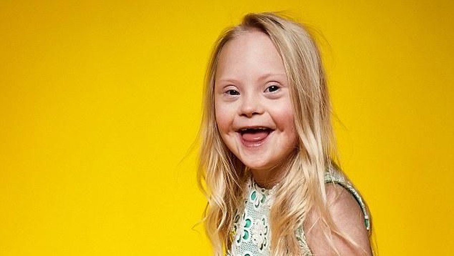 Keren! Saat Anak-anak dengan Disabilitas Jadi Model