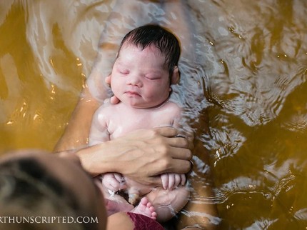 Meski Lahir dengan Down Syndrome, Bagiku Kau Tetap Sempurna, Nak