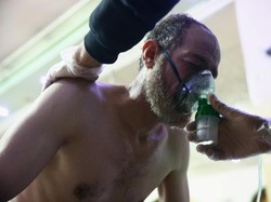 Tak Semua Komorbid Asma Memperberat Gejala Pasien Corona