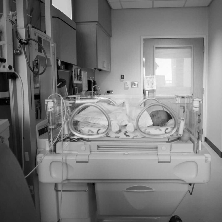 <p>Saat dicek kondisi fisiknya, jantung Amadeus lemah sehingga ia harus menjalani operasi jantung. (Foto: Unscripted Birth)</p>