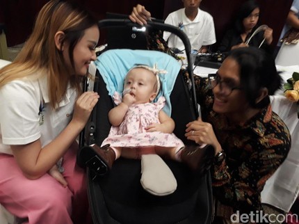 CMD, Kondisi Langka yang Dialami Anak Bungsu Joanna Alexandra