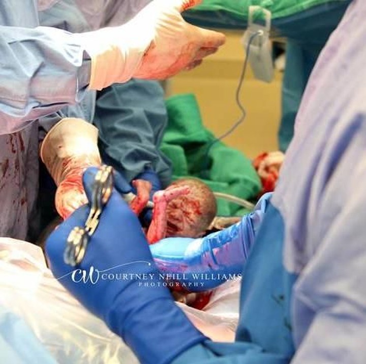 <p>Proses persalinannya begitu cepat, hal ini karena tim medis telah melakukan latihan terlebih dahulu. (Foto: Courtney Neill Williams Photography)</p>