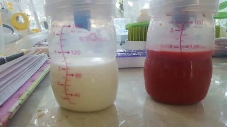 Para ibu ini membagikan cerita dan foto kondisi ASI-nya saat mengalami masalah menyusui.