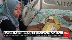 Balita Korban Penganiayaan Masih Menjalani Perawatan Intensif