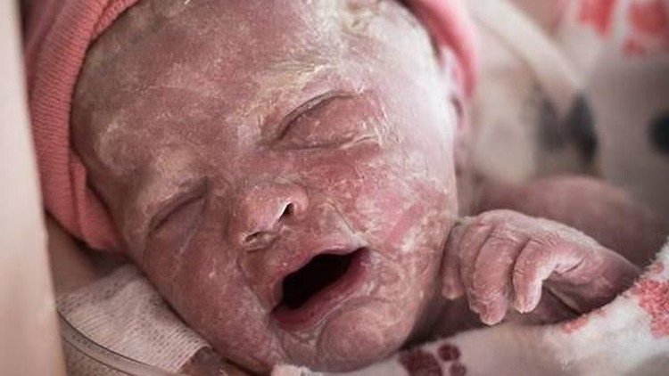 Seorang fotografer menangkap perbedaan kondisi bayi yang baru banget lahir dan satu jam setelahnya. Beda banget, Bun.