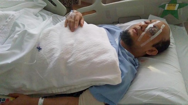 Kondisi mata kiri Novel Baswedan semakin membaik usai operasi tahap kedua di Singapura. Dia sudah bisa melihat bayangan tubuh orang melalui mata kirinya.