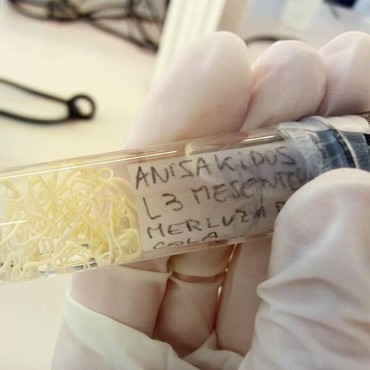 Waspada! 4 Jenis Cacing yang Ada di Ikan Ini Bisa Menginfeksi Manusia