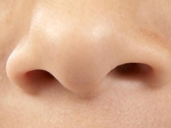 Gara-gara Penyakit Autoimun Langka, Hidung Wanita Ini Ambles
