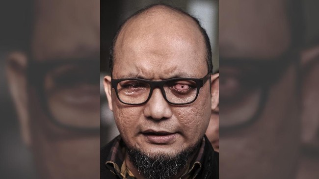 Kondisi mata Novel Baswedan disebut semakin memburuk. Dia kembali berobat ke Singapura dan tak bisa mengikuti rekonstruksi perkara menjelang subuh nanti.