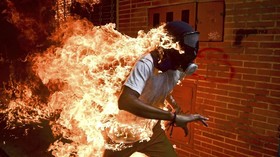 Foto Demonstran Venezuela Terbakar Raih Penghargaan