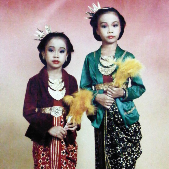 <p>Siapa yang dulunya begini hayo? (Foto: Instagram/yuvina_yuviii)</p>